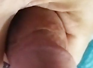 Appearance of the glans penis in different situations